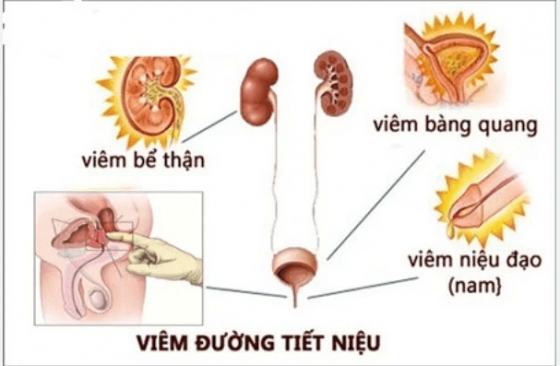 TIETNIET.png