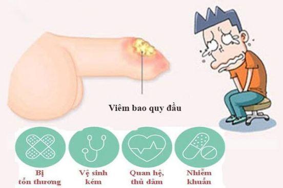 nguyen-nhan-gay-benh-viem-bao-quy-dau.jpeg